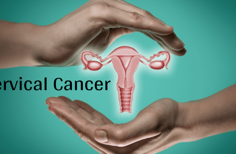 Men and Cervical Cancer: What Men Can Do To Stop Spread of HPV