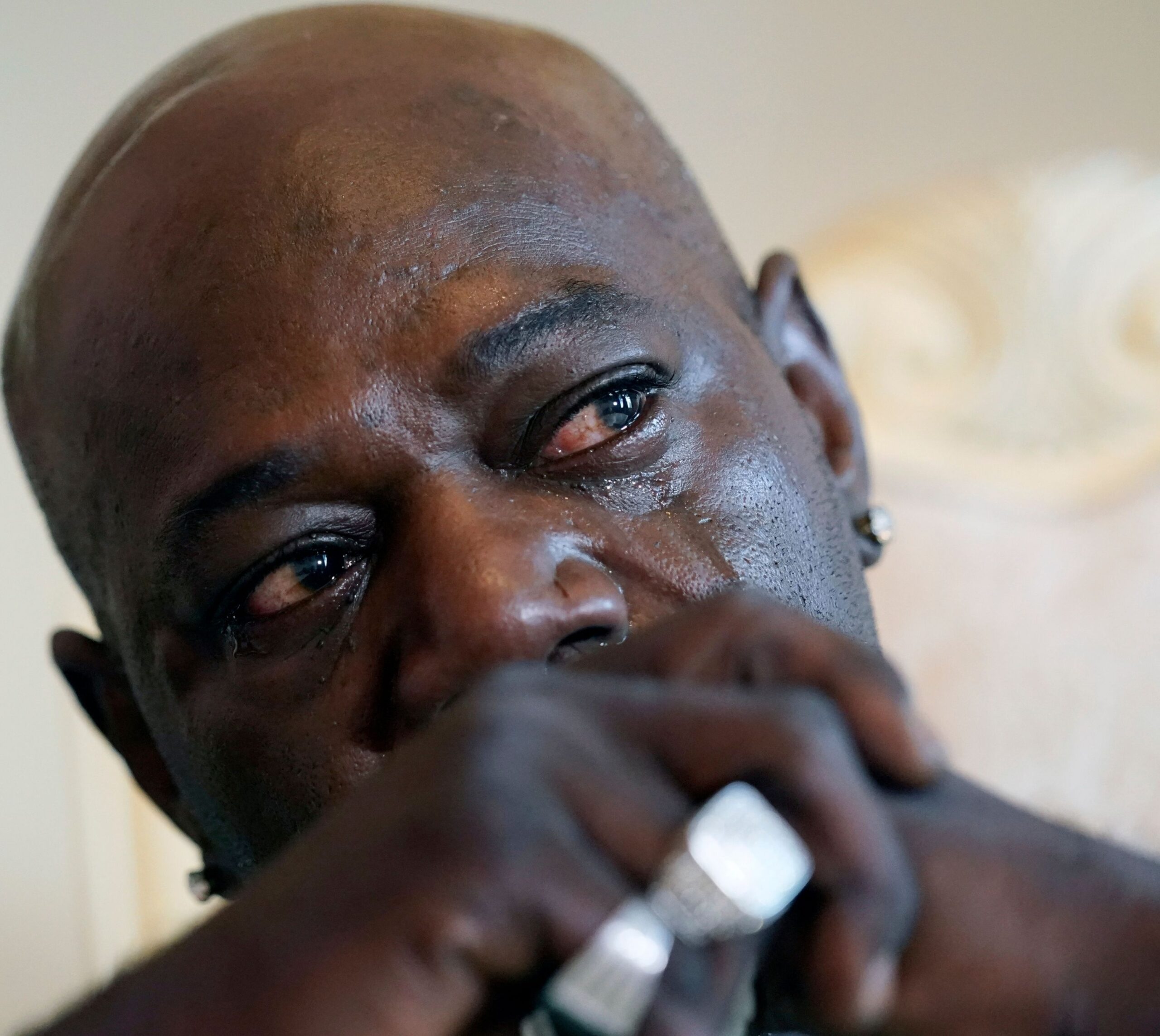 Aaron Larry Bowman : Man 'cuts off his genitals in his sleep while dreaming he was chopping meat'