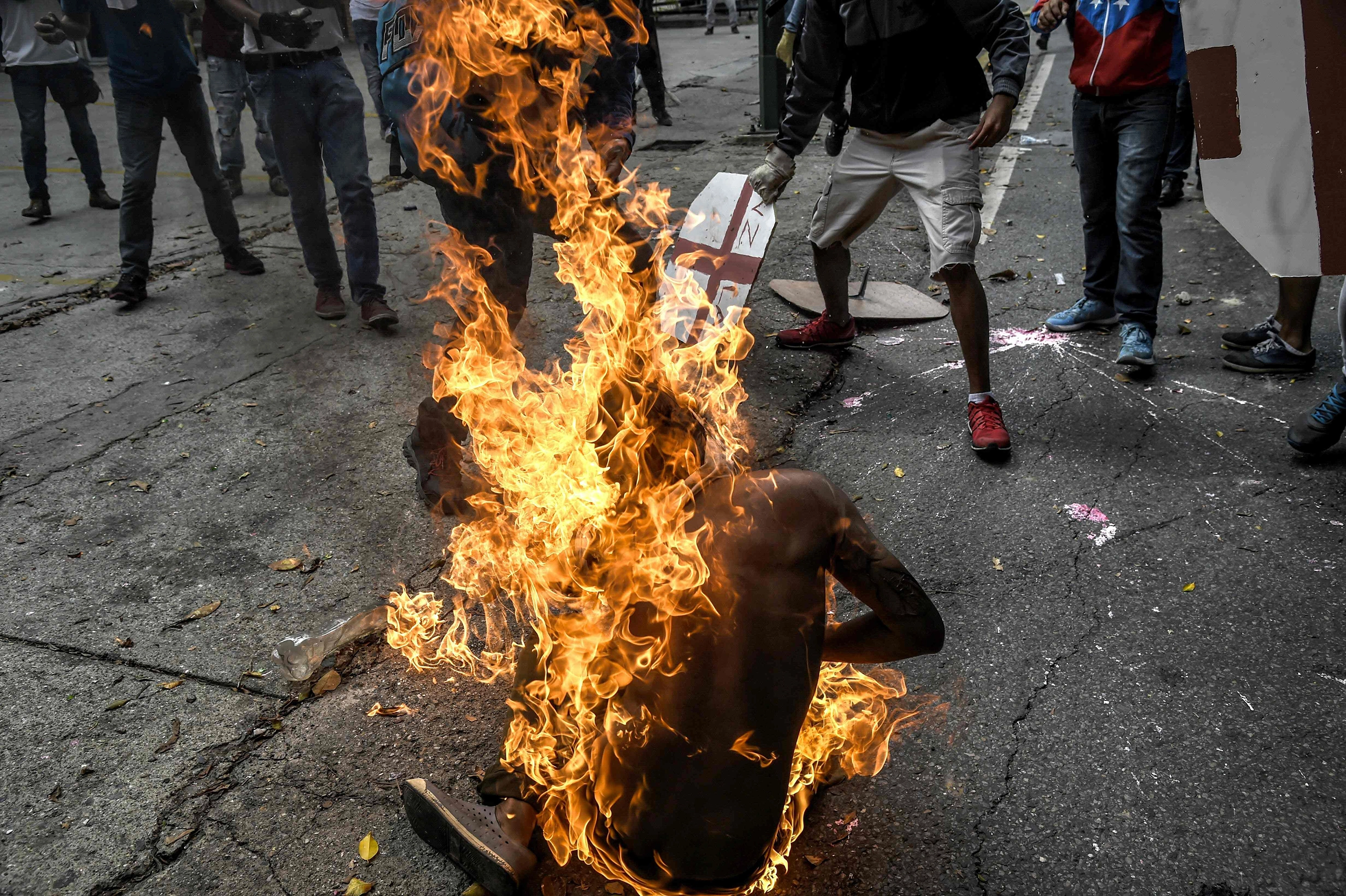 Ugandan Man Burns Himself to Death After Wife Jilts Him 2 Ugandan Man on fire