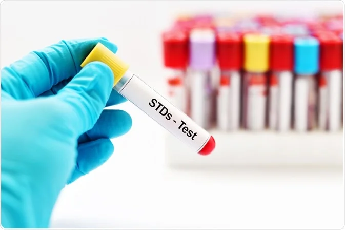 partners should test regularly for sexually transmited infections