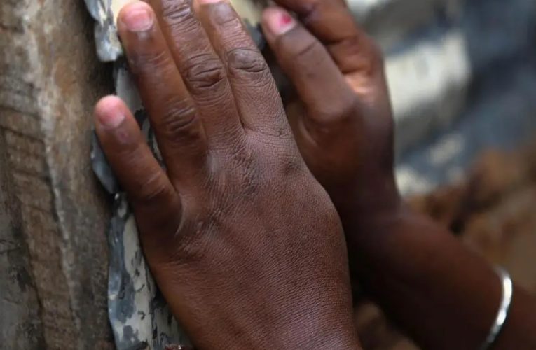 Medical Worker in Uganda Rapes Underage Student