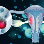 Cervical Cancer Awareness Month: 4 Ways to Protect Yourself From Cervical Cancer 4