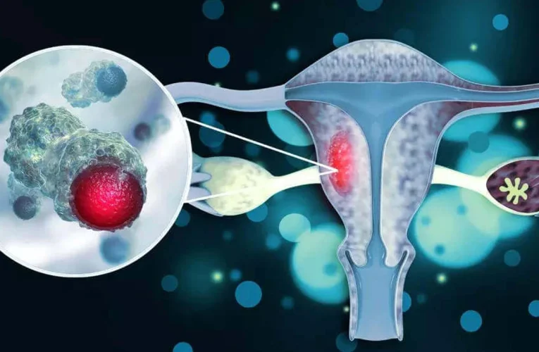 Cervical Cancer Awareness Month: 4 Ways to Protect Yourself From Cervical Cancer