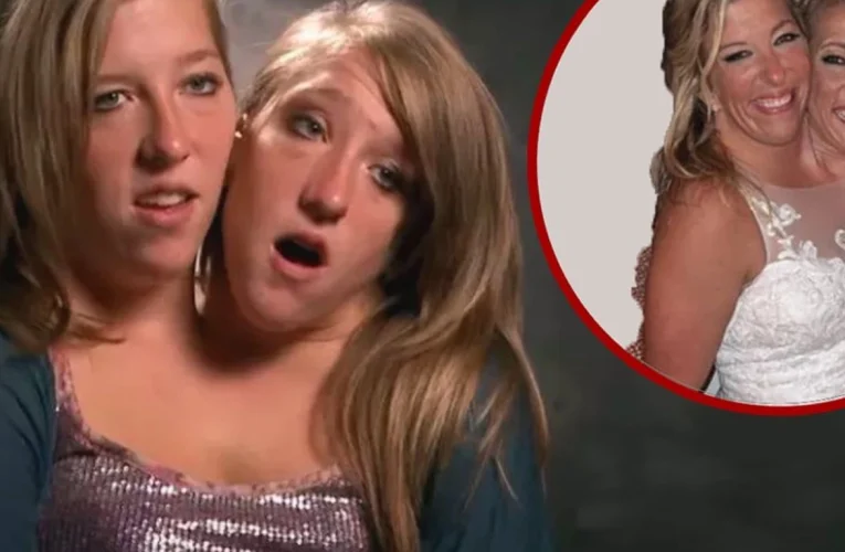 Conjoined Twins Abby Hensel Secretly Tie The Knot In Glamorous Wedding Gown
